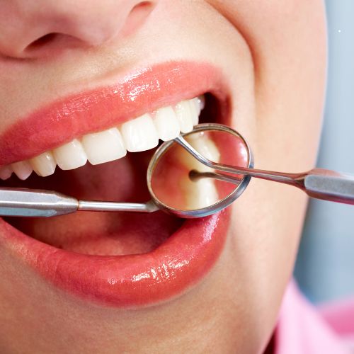 Best Dentistry in Perinthalmanna